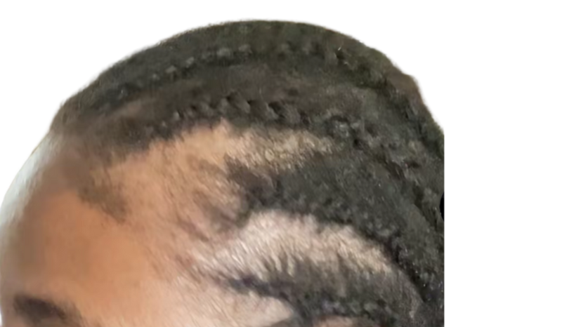 Before image